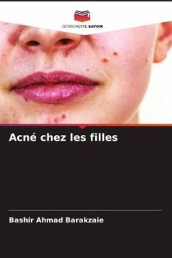 Acné chez les filles - Barakzaie, Bashir Ahmad