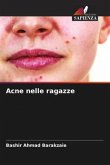 Acne nelle ragazze