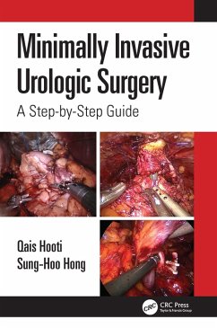 Minimally Invasive Urologic Surgery (eBook, PDF) - Hooti, Qais; Hong, Sung-Hoo