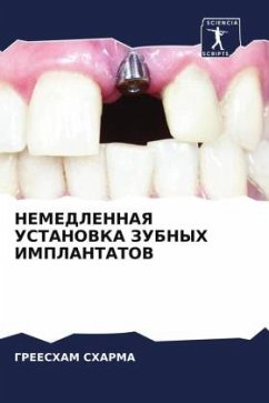 NEMEDLENNAYa USTANOVKA ZUBNYH IMPLANTATOV - Sharma, Greesham