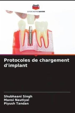 Protocoles de chargement d'implant - Singh, Shubhaani;Nautiyal, Mansi;Tandan, Piyush