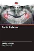 Dents incluses