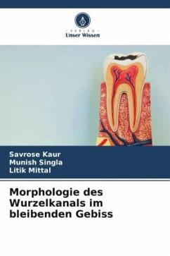 Morphologie des Wurzelkanals im bleibenden Gebiss - Kaur, Savrose;Singla, Munish;Mittal, Litik