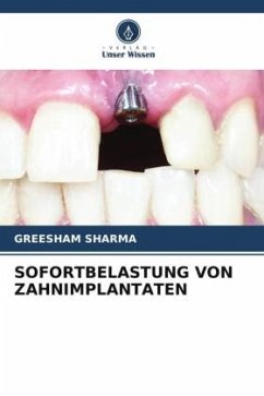 SOFORTBELASTUNG VON ZAHNIMPLANTATEN - Sharma, Greesham