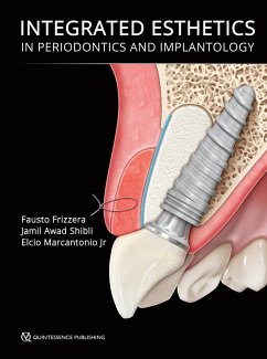 Integrated Esthetics in Periodontics and Implantology (eBook, ePUB) - Frizzera, Fausto; Shibli, Jamil Awad