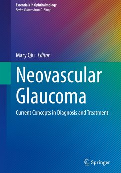 Neovascular Glaucoma