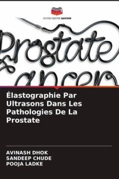 Élastographie Par Ultrasons Dans Les Pathologies De La Prostate - Dhok, Avinash;Chude, Sandeep;Ladke, Pooja