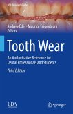 Tooth Wear (eBook, PDF)