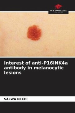 Interest of anti-P16INK4a antibody in melanocytic lesions - Nechi, Salwa