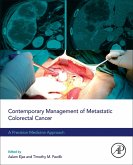 Contemporary Management of Metastatic Colorectal Cancer (eBook, ePUB)