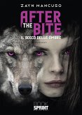 After the bite (eBook, ePUB)