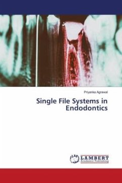 Single File Systems in Endodontics - Agrawal, Priyanka