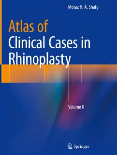 Atlas of Clinical Cases in Rhinoplasty - Shafy, Motaz H. A.