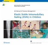 Elastic Stable Intramedullary Nailing (ESIN) in Children (eBook, ePUB)