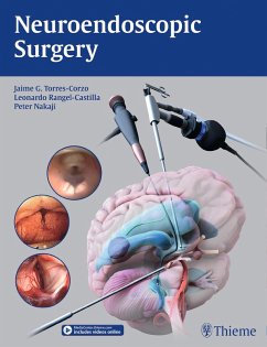 Neuroendoscopic Surgery (eBook, ePUB)