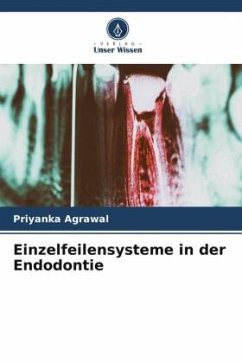 Einzelfeilensysteme in der Endodontie - Agrawal, Priyanka