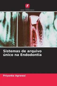 Sistemas de arquivo único na Endodontia - Agrawal, Priyanka