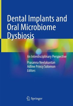 Cover Dental Implants and Oral Microbiome Dysbiosis (eBook, PDF)