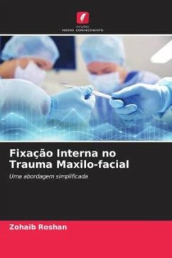 Fixação Interna no Trauma Maxilo-facial - Roshan, Zohaib