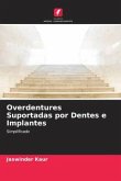 Overdentures Suportadas por Dentes e Implantes