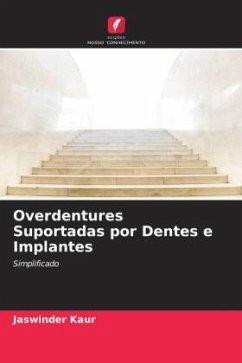 Overdentures Suportadas por Dentes e Implantes - Kaur, Jaswinder