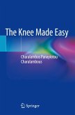 The Knee Made Easy