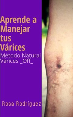 Aprende a Manejar tus Várices Método Natural Várices _Off_ (eBook, ePUB) - Rodriguez, Rosa