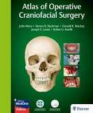 Atlas of Operative Craniofacial Surgery (eBook, PDF)