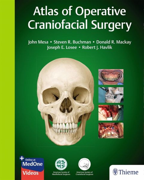 Atlas of Operative Craniofacial Surgery (eBook, PDF) Atlas of Operative Craniofacial Surgery (eBook, PDF)