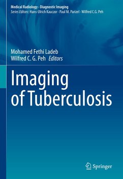 Imaging of Tuberculosis (eBook, PDF)