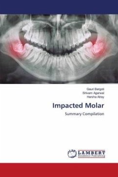 Impacted Molar - Bargoti, Gauri;Agarwal, Shivam;Atray, Harsha