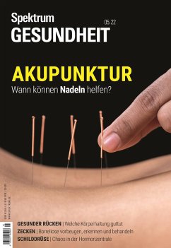 Spektrum Gesundheit- Akupunktur (eBook, PDF) - Spektrum der Wissenschaft