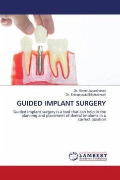 GUIDED IMPLANT SURGERY