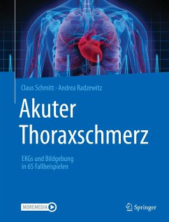 Akuter Thoraxschmerz (eBook, PDF) - Schmitt, Claus; Radzewitz, Andrea