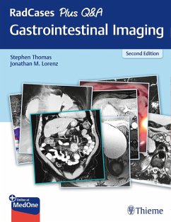RadCases Plus Q&A Gastrointestinal Imaging (eBook, ePUB) - Thomas, Stephen; Lorenz, Jonathan M.