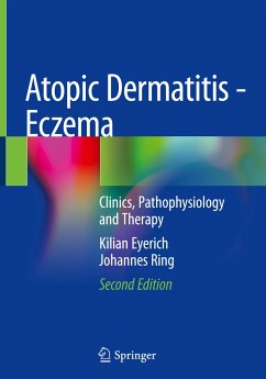 Atopic Dermatitis - Eczema - Eyerich, Kilian;Ring, Johannes