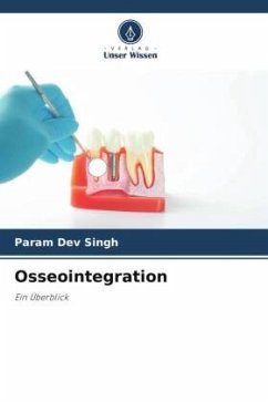 Osseointegration - Singh, Param Dev;Kumar, Varun;Arya, Geeta