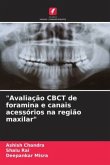 &quote;Avaliação CBCT de foramina e canais acessórios na região maxilar&quote;