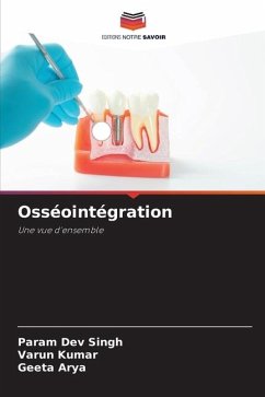 Osséointégration - Singh, Param Dev;Kumar, Varun;Arya, Geeta