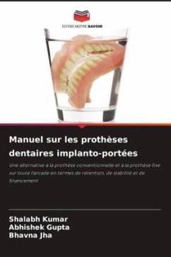 Manuel sur les prothèses dentaires implanto-portées - Kumar, Shalabh;Gupta, Abhishek;Jha, Bhavna