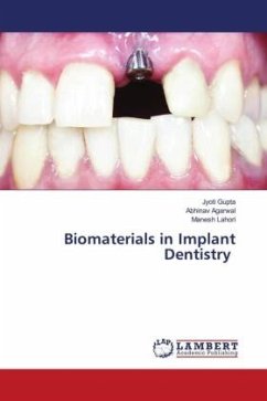 Biomaterials in Implant Dentistry - Gupta, Jyoti;Agarwal, Abhinav;Lahori, Manesh