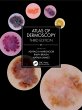 Atlas of Dermoscopy (eBook, ePUB) - Bild 1