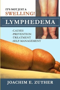 It's Not Just a Swelling! Lymphedema