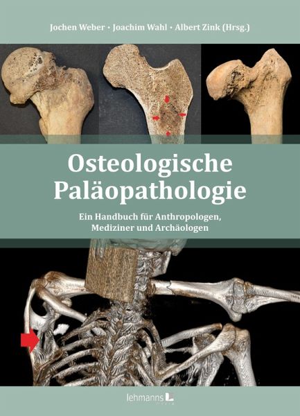 Osteologische Paläopathologie (eBook, PDF) Osteologische Paläopathologie (eBook, PDF)