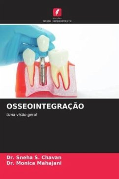 OSSEOINTEGRAÇÃO - Chavan, Dr. Sneha S.;Mahajani, Dr. Monica