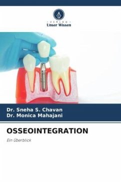 OSSEOINTEGRATION - Chavan, Dr. Sneha S.;Mahajani, Dr. Monica