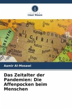 Das Zeitalter der Pandemien: Die Affenpocken beim Menschen - Al-Mosawi, Aamir