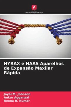 HYRAX e HAAS Aparelhos de Expansão Maxilar Rápida - M. Johnson, Joyal;Aggarwal, Ankur;Kumar, Reena R.