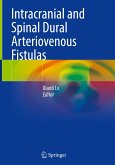 Intracranial and Spinal Dural Arteriovenous Fistulas