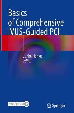 Basics of Comprehensive IVUS-Guided PCI